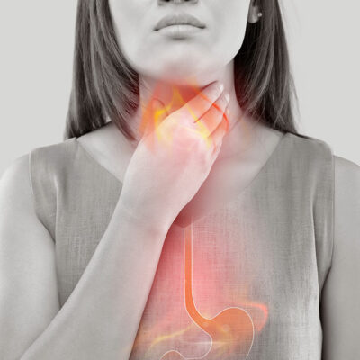 The Primary Causes of Acid Reflux