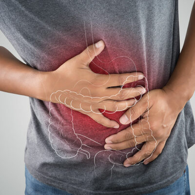 Ulcerative Colitis &#8211; Signs and Trigger Foods