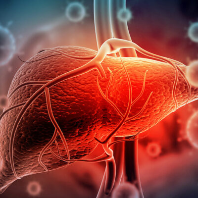 5 Complications of Hepatitis C