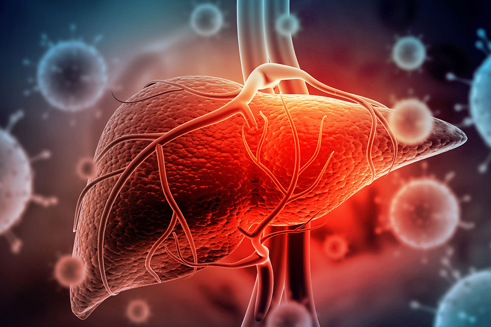 5 Complications of Hepatitis C