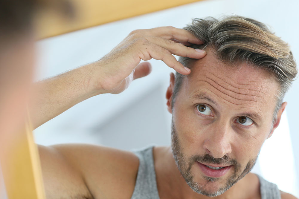 5 Ways to Manage Hair Loss in Men