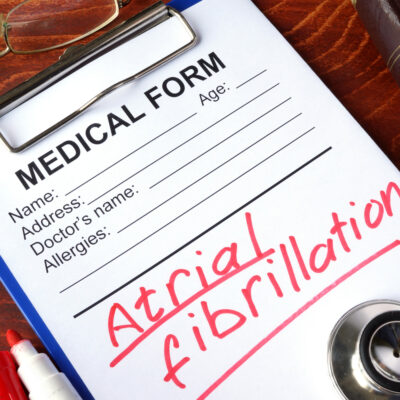 7 Causes of AFib to Know